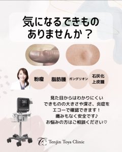 エコーで皮膚のできものを詳しく診てみませんか？