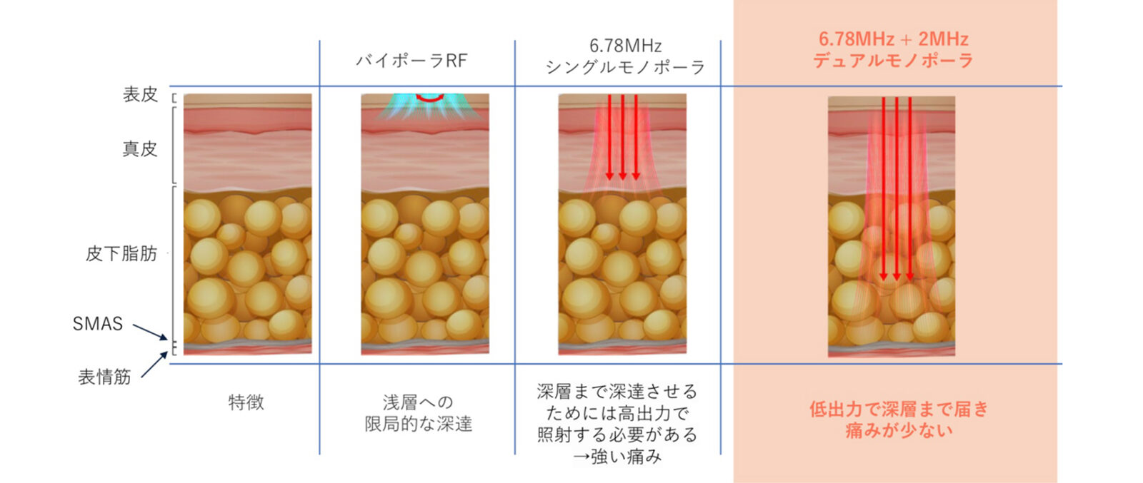 XERFの照射の深さの調整