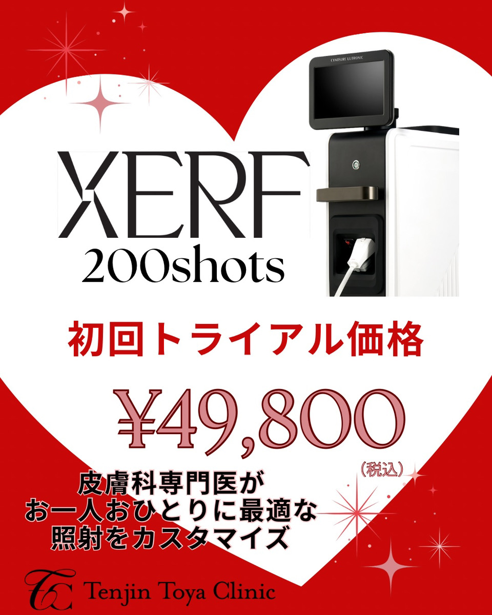 XERF200shots初回トライアル