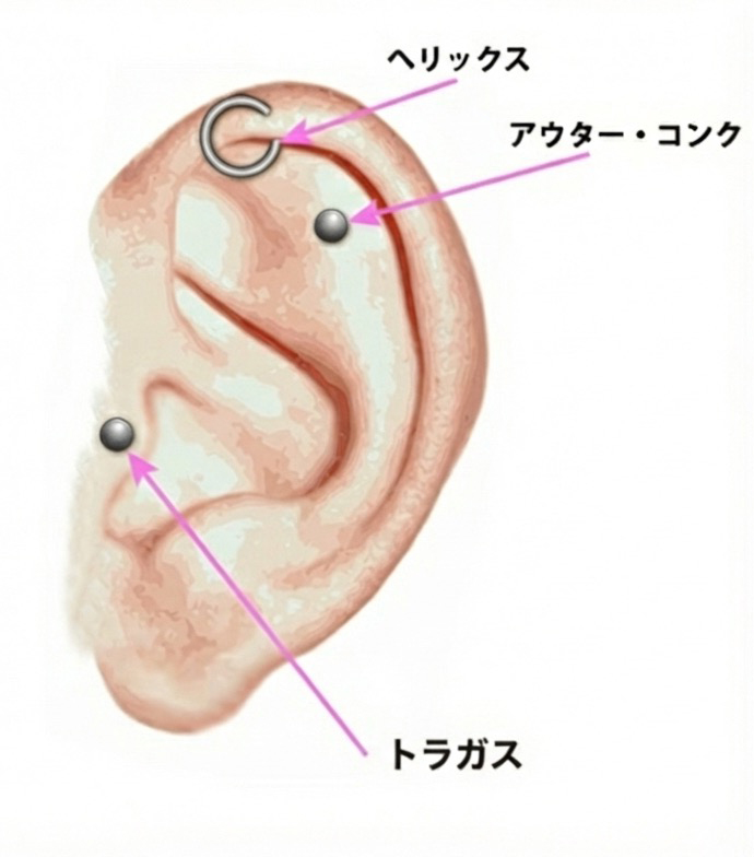 軟骨（当院取扱いピアスor持ち込み）