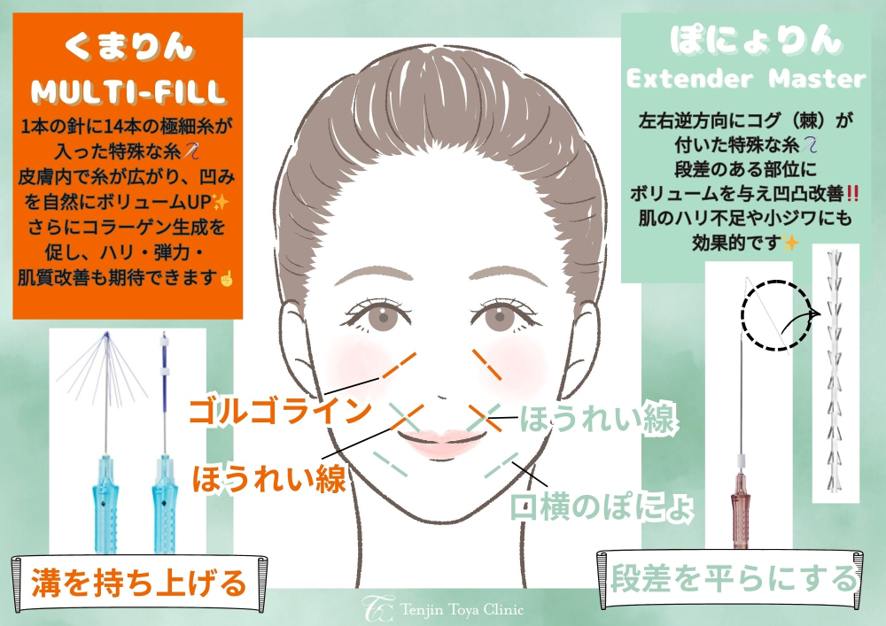 ぽにょりん・くまりんはこのような方におすすめ