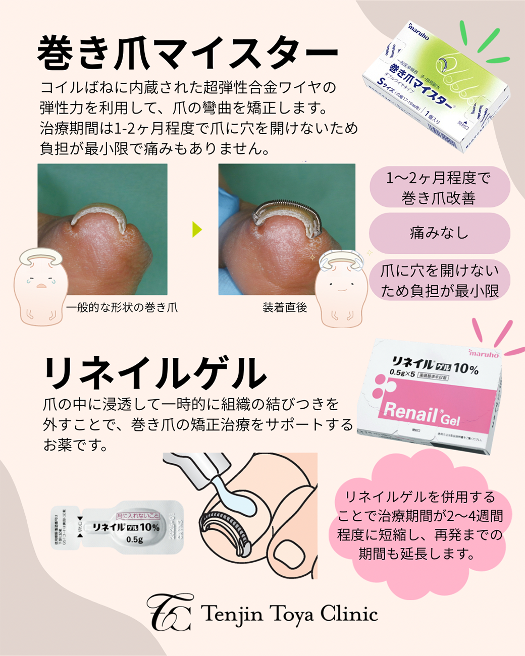 プルリアル（Pluryal）